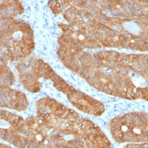 EpCAM Antibody in Immunohistochemistry (IHC (P))