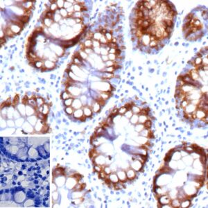 Mucin 2 Antibody in Immunohistochemistry (IHC (P))