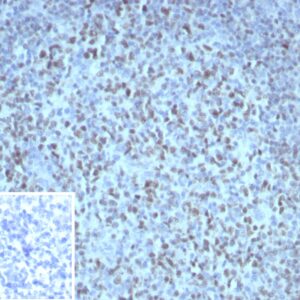 OCT2 Antibody in Immunohistochemistry (IHC (P))