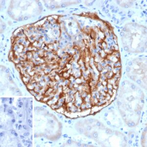 PLA2R1 Antibody in Immunohistochemistry (IHC (P))