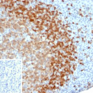 TCL1 Antibody in Immunohistochemistry (IHC (P))