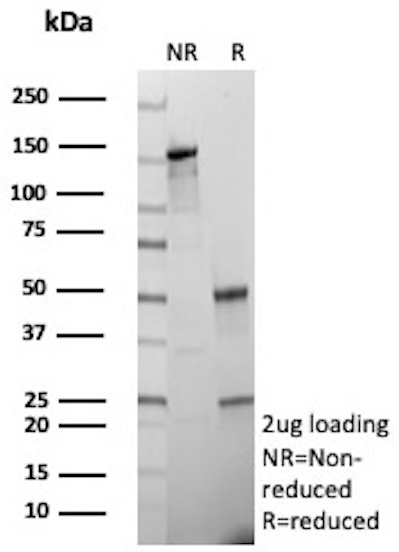 SDS-PAGE Analysis of Purified ABCC4 Mouse Monoclonal Antibody (ABCC4/9017). Confirmation of Purity and Integrity of Antibody. ABCC4 Antibody in SDS-PAGE