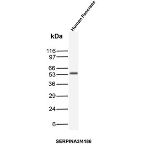 SERPINA3 Antibody in Western Blot (WB)