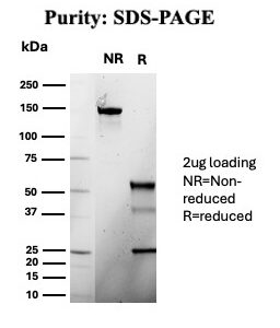IGHG1 Antibody in SDS-PAGE