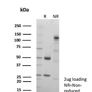 MUC5AC Antibody in SDS-PAGE