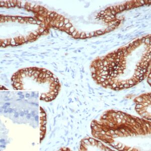 ABCC4 Antibody in Immunohistochemistry (IHC (P))