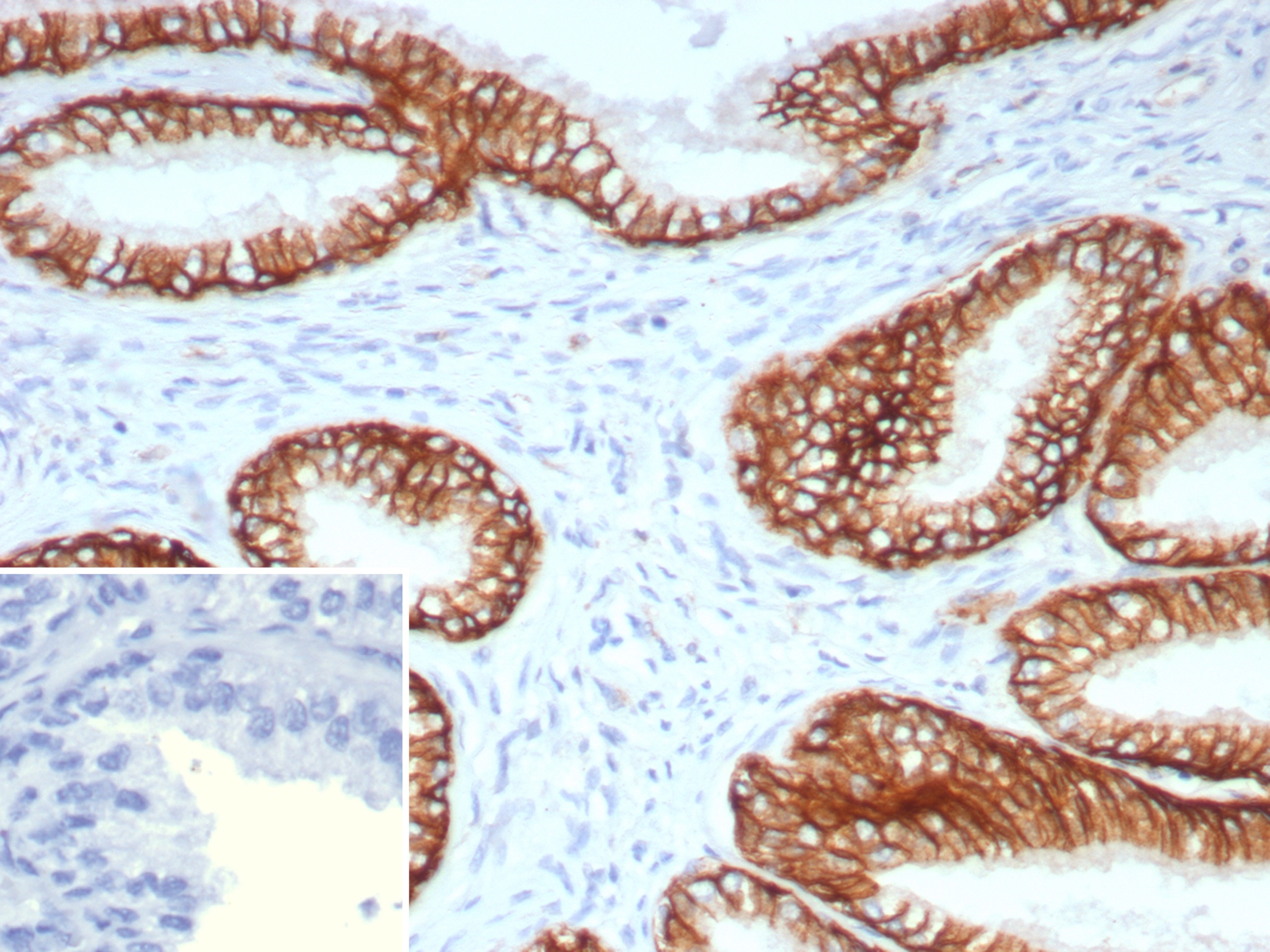 Formalin-fixed, paraffin-embedded human prostate stained with ABCC4 Mouse Monoclonal Antibody (ABCC4/9017). HIER: Tris/EDTA, pH9.0, 45min. 2°: HRP-polymer, 30min. DAB, 5min. ABCC4 Antibody in Immunohistochemistry (IHC (P))