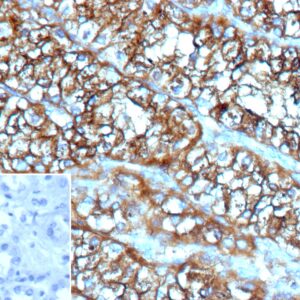 CD70 Antibody in Immunohistochemistry (IHC (P))