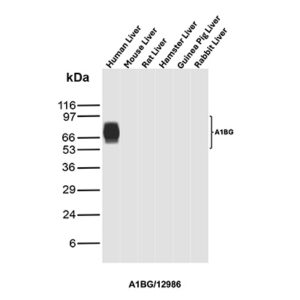 A1BG Antibody in Western Blot (WB)