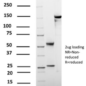 Carcinoembryonic Antigen (CEA) / CD66 Antibody in SDS-PAGE