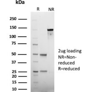 Carcinoembryonic Antigen (CEA) / CD66 Antibody in SDS-PAGE
