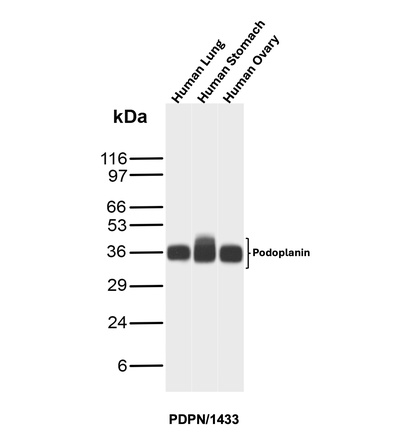 Western blot analysis of human lung, stomach and ovary tissue lysates using PDPN Mouse Monoclonal Antibody (PDPN/1433). PDPN Antibody in Western Blot (WB)