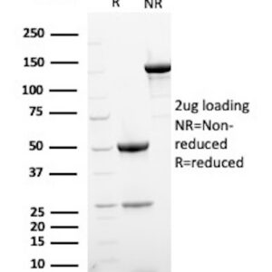 Podoplanin (PDPN) (Lymphatic Endothelial & Mesothelial Marker) Antibody in SDS-PAGE