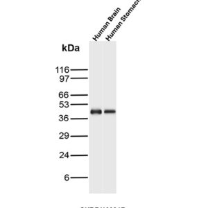 CKBB Antibody in Western Blot (WB)