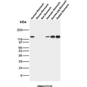 DBN1 Antibody in Western Blot (WB)