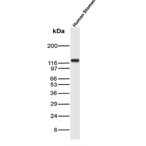 DBN1 Antibody in Western Blot (WB)