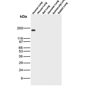 A2M Antibody in Western Blot (WB)