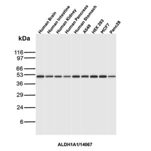 ALDH1A1 Antibody in Western Blot (WB)