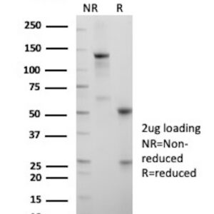 Recombinant Fumarate hydratase, mitochondrial Antibody in SDS-PAGE