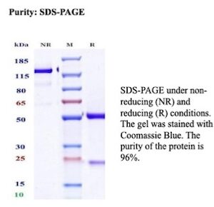 Recombinant FSH-beta (Follicle Stimulating Hormone-beta) Antibody in SDS-PAGE