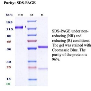 Recombinant FSH-beta (Follicle Stimulating Hormone-beta) Antibody in SDS-PAGE