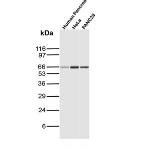 GAD2 Antibody in Western Blot (WB)