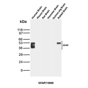 GFAP Antibody in Western Blot (WB)