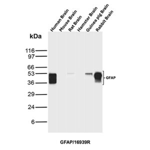 GFAP Antibody in Western Blot (WB)