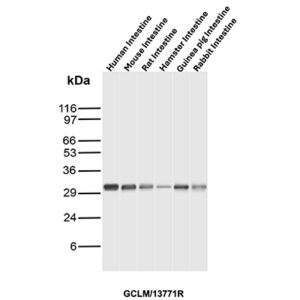 GCLM Antibody in Western Blot (WB)