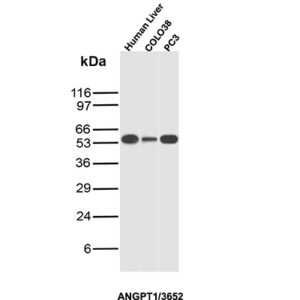 ANGPT1 Antibody in Western Blot (WB)