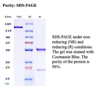Recombinant Hemoglobin subunit alpha Antibody in SDS-PAGE