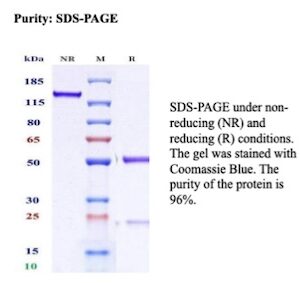 Recombinant Hemoglobin subunit alpha Antibody in SDS-PAGE