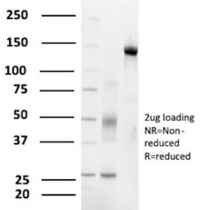 KCNIP2 / KCHIP2 Antibody in SDS-PAGE