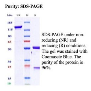 Recombinant Tenascin C (Stromal Marker for Epithelial Malignancy) Antibody in SDS-PAGE