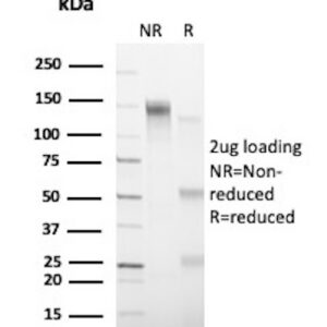 immunoglobulin heavy constant gamma 2 (G2m marker) Antibody in SDS-PAGE