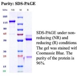 Recombinant Interleukin-1 receptor type 1 Antibody in SDS-PAGE