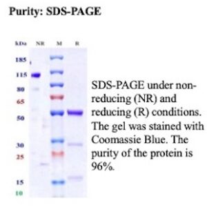 Recombinant Interleukin-4 receptor subunit alpha Antibody in SDS-PAGE