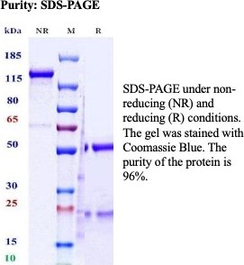 Recombinant Interleukin-5 receptor subunit alpha Antibody in SDS-PAGE