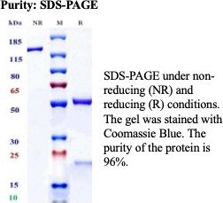 Recombinant Interleukin-6 receptor subunit alpha Antibody in SDS-PAGE