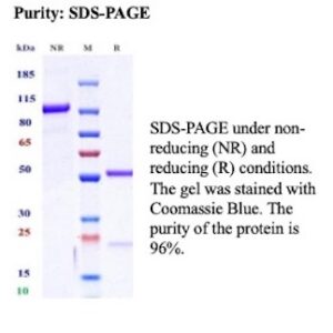 Recombinant Interleukin-13 receptor subunit alpha-1 Antibody in SDS-PAGE