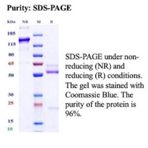 Recombinant Interleukin-18 Antibody in SDS-PAGE