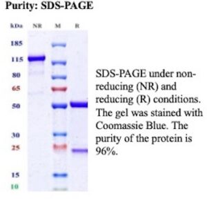 Recombinant Integrin alpha-IIb Antibody in SDS-PAGE