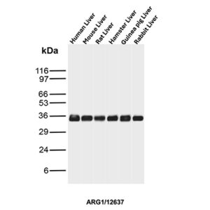ARG1 Antibody in Western Blot (WB)
