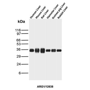 ARG1 Antibody in Western Blot (WB)