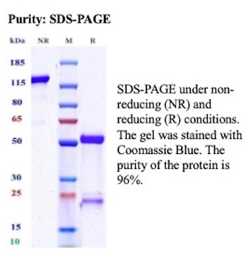 SDS-PAGE Analysis of Purified Recombinant Lymphocyte Activation Gene 3 (LAG-3) (Negative Checkpoint Regulator) Rabbit Monoclonal Antibody (LAG3/16984R). Confirmation of Purity and Integrity of Antibody. Recombinant Lymphocyte Activation Gene 3 (LAG-3) (Negative Checkpoint Regulator) Antibody in SDS-PAGE