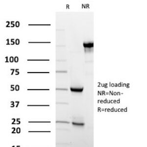 Microtubule-associated protein 2 Antibody in SDS-PAGE