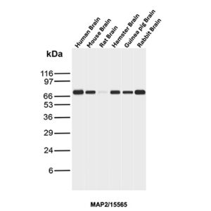 MAP2 Antibody in Western Blot (WB)