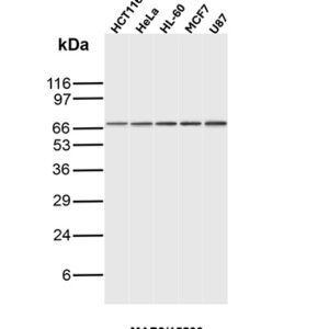 MAP2 Antibody in Western Blot (WB)
