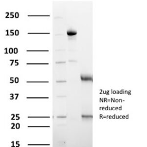 Myelin Basic Protein Antibody in SDS-PAGE