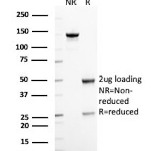 CD10 (Membrane Metalloendopeptidase) Antibody in SDS-PAGE